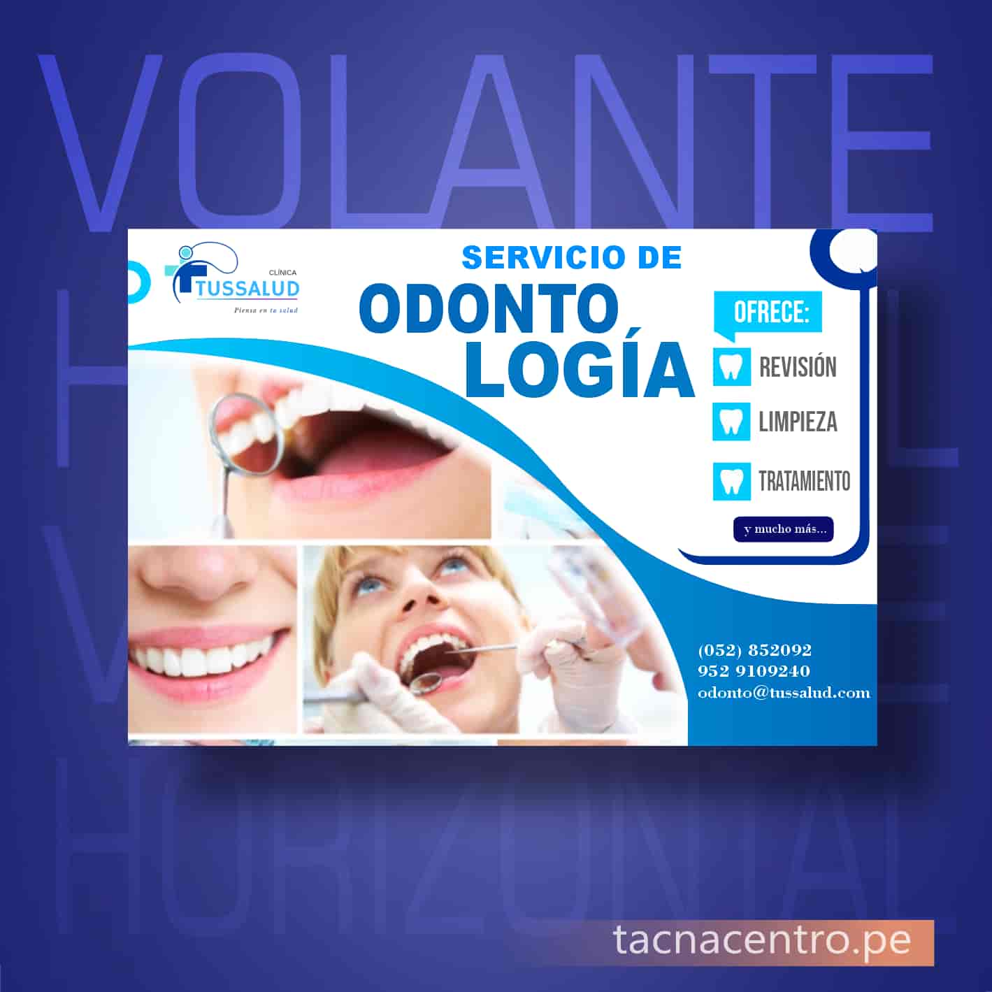 ejemplos de volantes publicitarios y flyer para servicios odontologicos dentista con diseño personalizado y orientacion horizontal efecto brilloso - imprenta online tacna centro peru